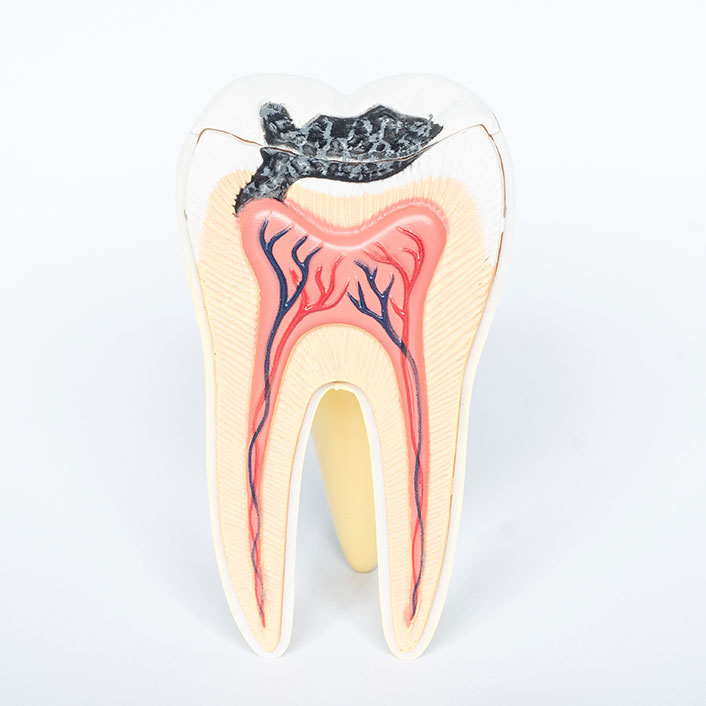 Restorative Dentistry - Dental Services